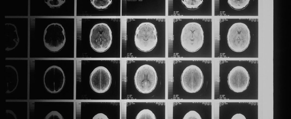 O Exame que a IA Já Faz Melhor que Alguns Médicos